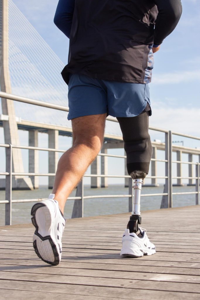 Prosthetics in Houston